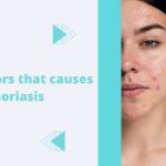 Risk factors that causes psoriasis