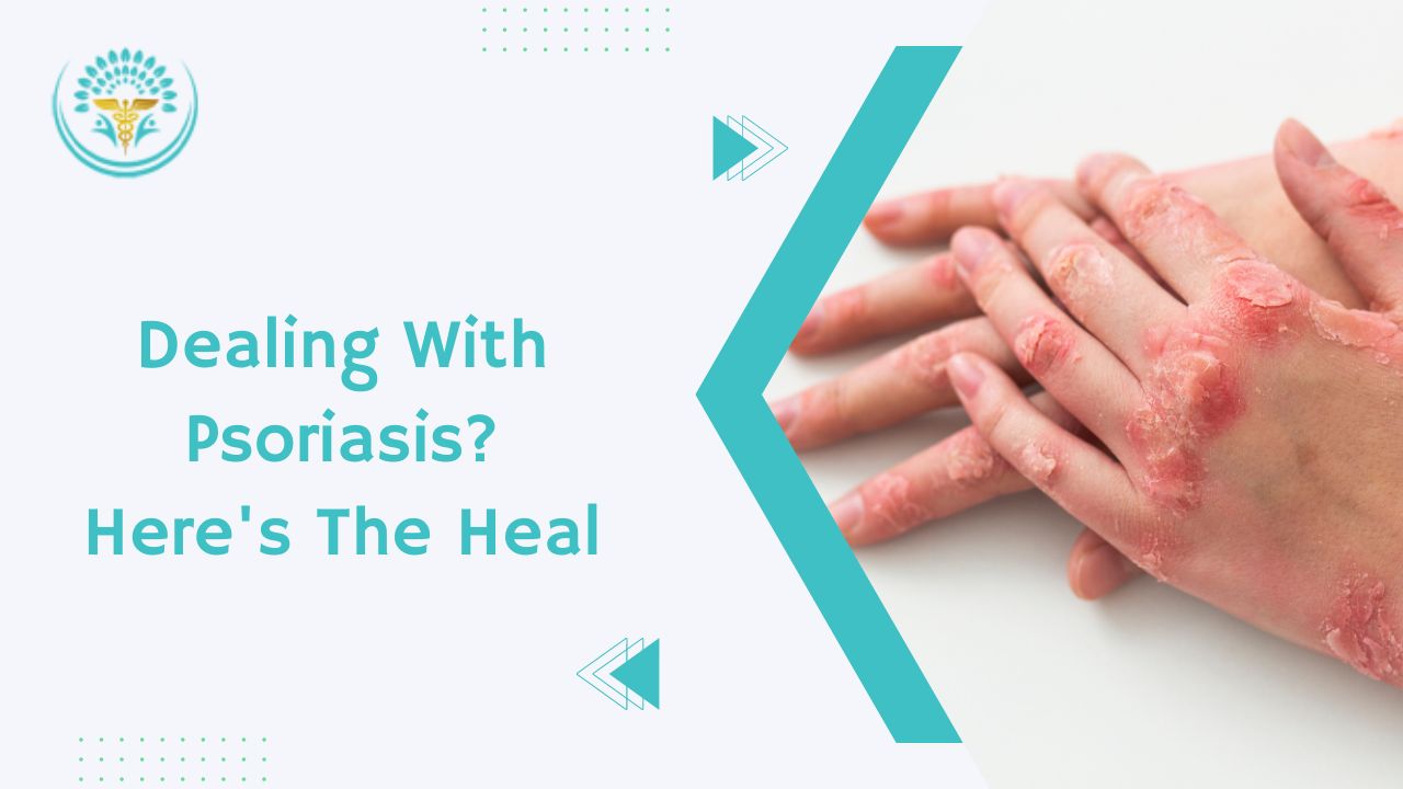 Dealing with psoriasis? here's the heal