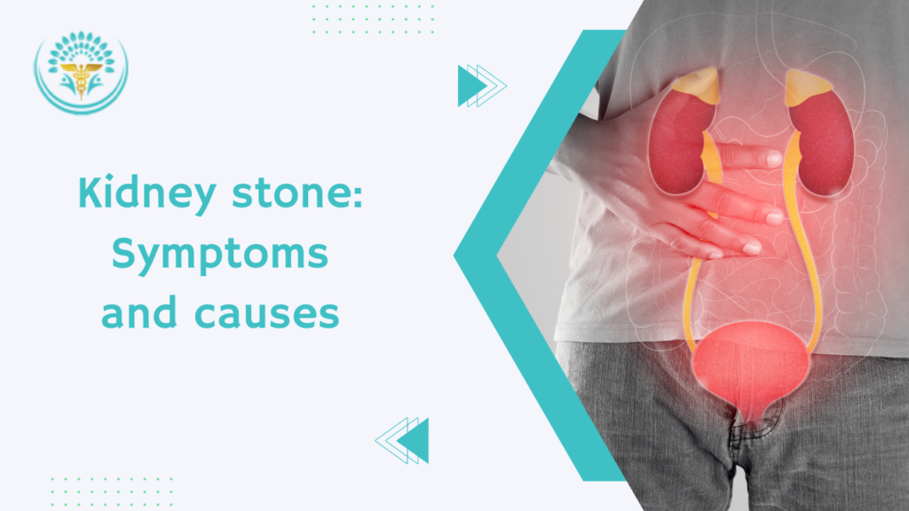 Kidney Stone: Symptoms And Causes