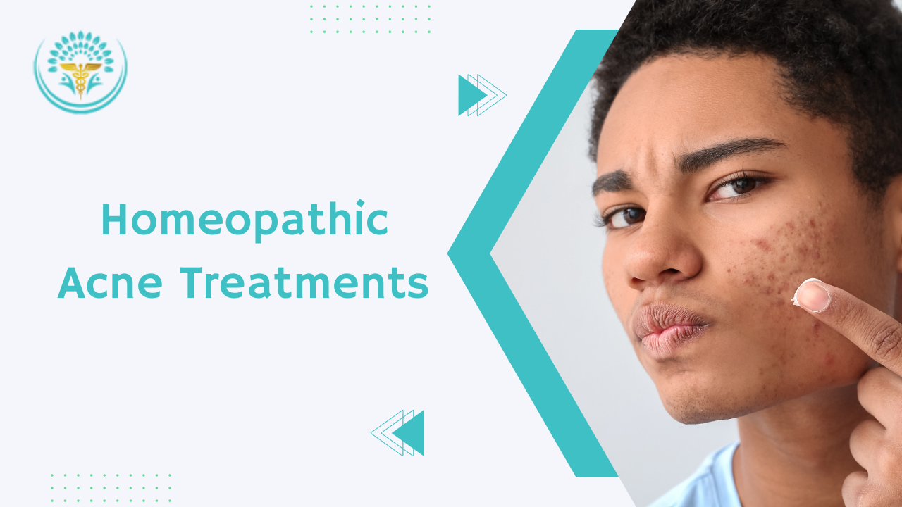 Homeopathic-acne-treatment