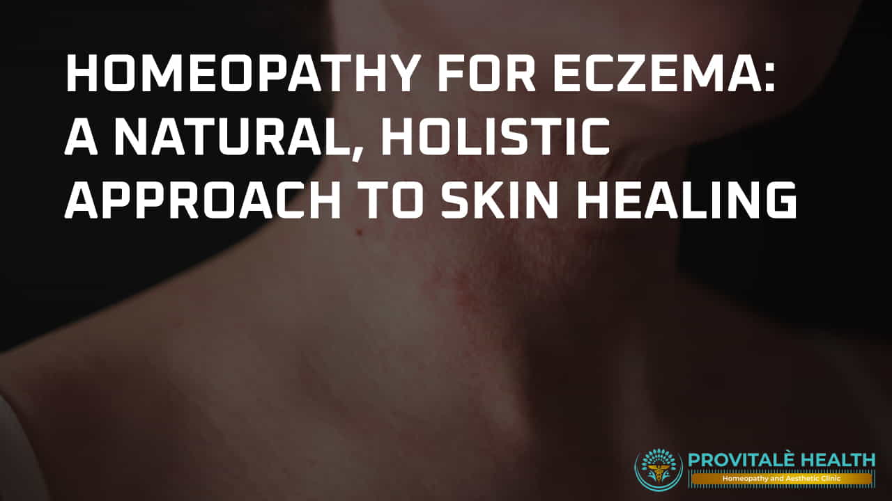 Homeopathy for Eczema