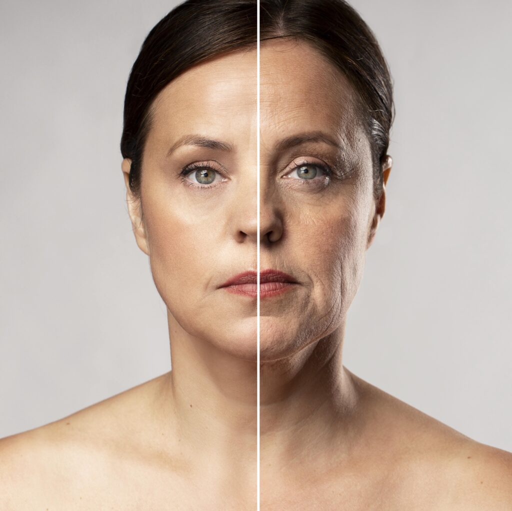 Anti-Aging Surgery