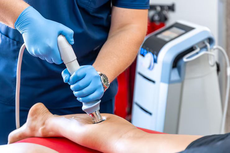 treatment for varicose
